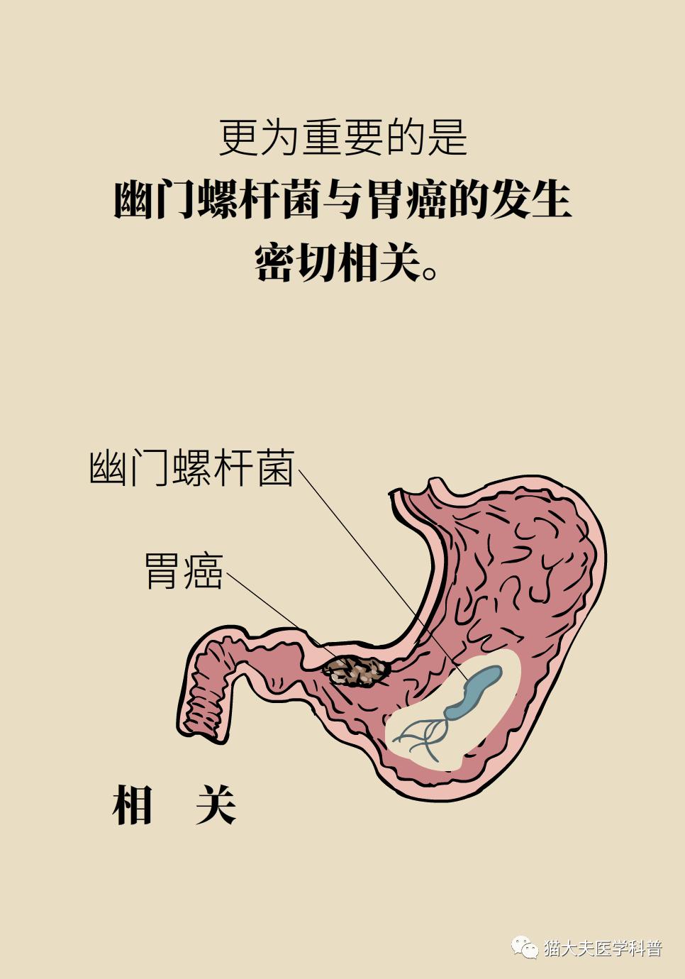 幽门螺旋菌如何杀死?幽门螺旋杆菌怎样才能杀灭